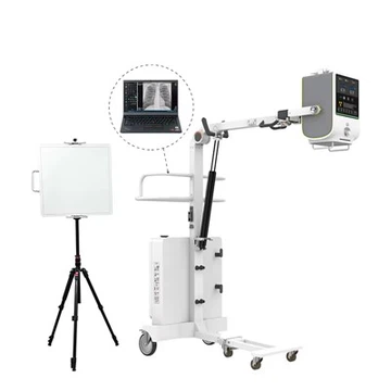 5KW Protable Automatic Veterinary Digital X Ray Machine