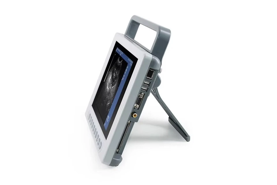 FTL-UV10 Portable Ultrasound Machine – Full Digital B-Mode Scanner best