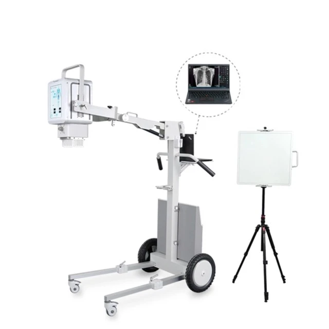 Digital Portable X-Ray Machine With DR 5.6KW