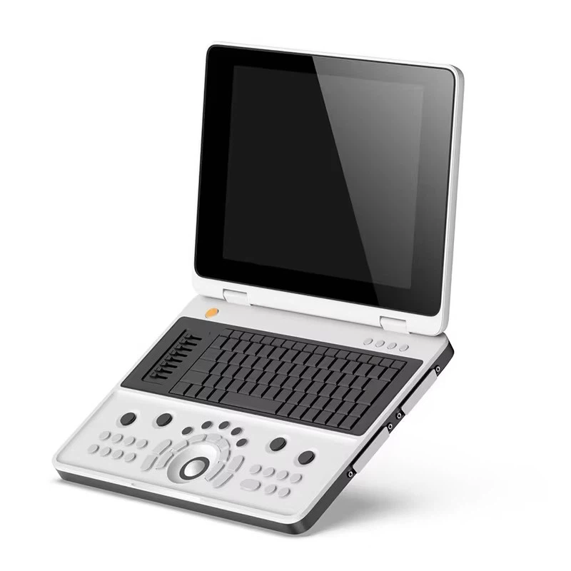Digital Ultrasound Imaging System