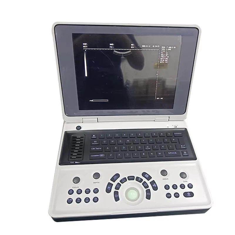 Digital Ultrasound Imaging System