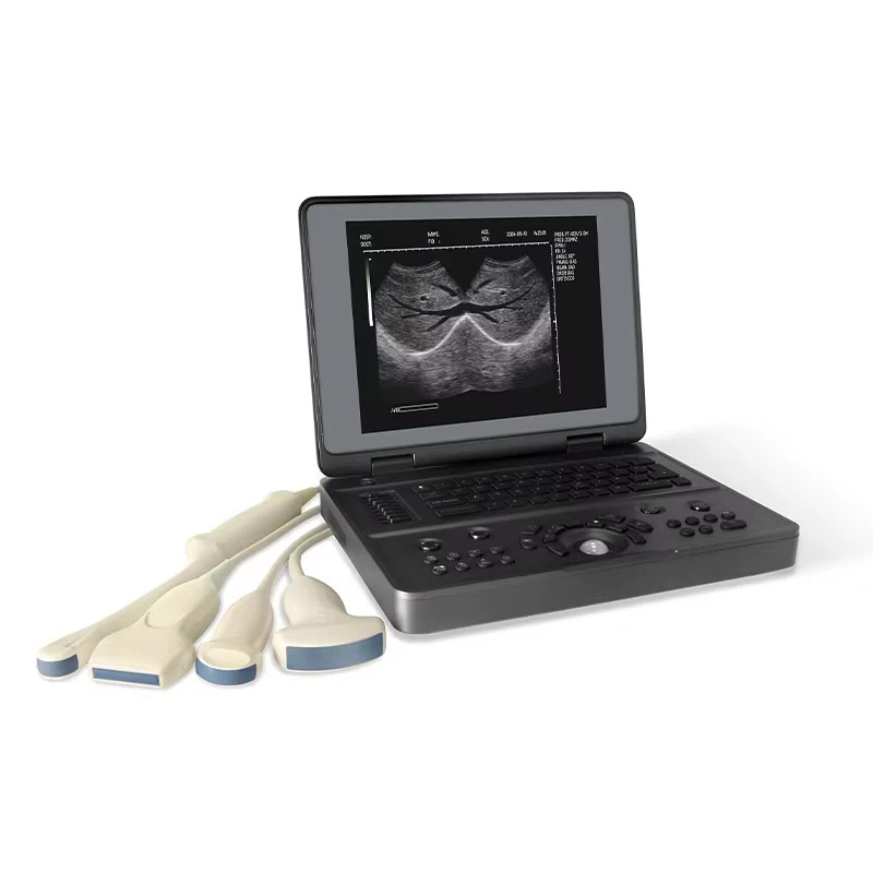 Digital Ultrasound Imaging System
