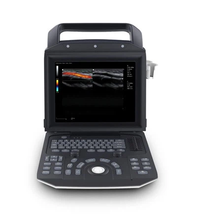 FTL-M5 Color Doppler Laptop Ultrasound System