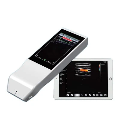 Portable Wireless Ultrasound Machine FTL-V5L