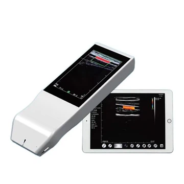 Portable Wireless Ultrasound Machine FTL-V5L