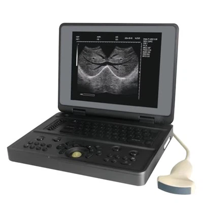 Digital Ultrasound Imaging System