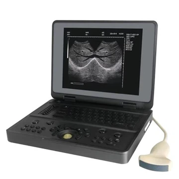 Digital Ultrasound Imaging System