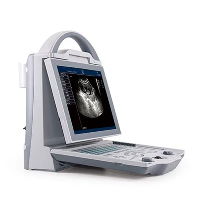 Portable Laptop Ultrasound Machine Scanner